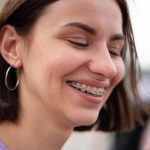 Metal Braces for Adults: A Modern Approach to Straightening Teeth