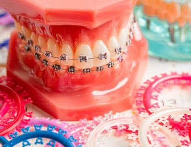 The Role of One Band Space Maintainers in Early Orthodontic Treatment