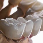 The Science of Aesthetics: Exploring Cosmetic Dentistry Techniques