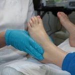 Why Choose Minimally Invasive Bunion Surgery For Your Foot Pain