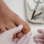 Why Choose Us for Toenail Injury in Scottsdale