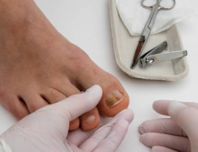 Why Choose Us for Toenail Injury in Scottsdale